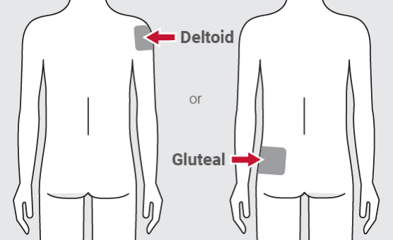 deltoid